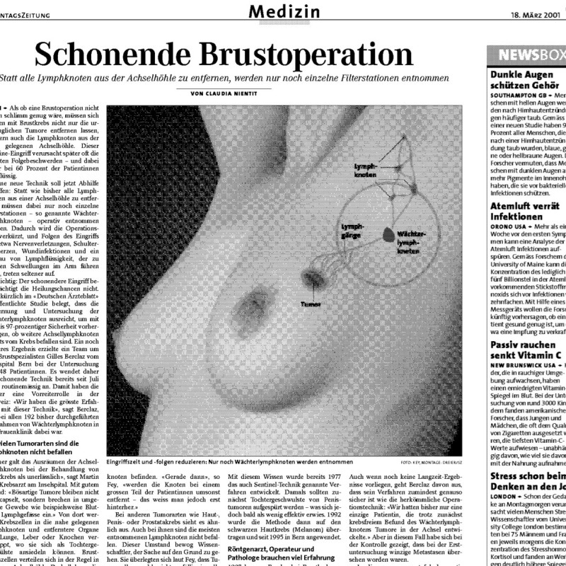 "Schonende Brustoperation"